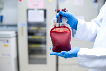 Doctor's hand holding blood bag in laboratory technician analyzing blood bag in blood bank