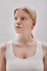 Minimal portrait of ethereal blonde girl with albinism posing against white background