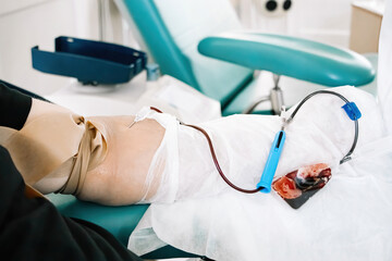 International Blood Donation Day. Man donates blood in medical laboratory.