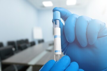 Scientist hand with blood sample tube