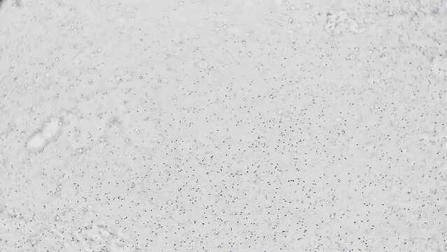 Human sperm in magnification 100 sperm swim quickly in ejaculate on white background. Biological test for human fertility and study of its reproduction. Medical analysis of semen of middle-aged man.