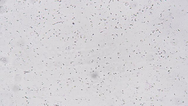 Examination biological material of semen under microscope in magnification of 200 spermatozoa on white background. Theme of male fertility and healthy lifestyle. Medical sperm tests of middle-aged man