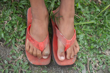 A boy is sitting with two feet on the ground