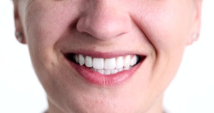 Woman smiling with beautiful snow white smile closeup. Dental treatment and prosthetics concept