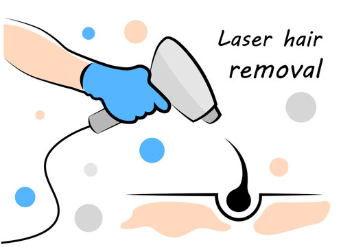 Laser hair removal. Photo epilation. A hand with a laser removes hair. Vector illustration in doodle style