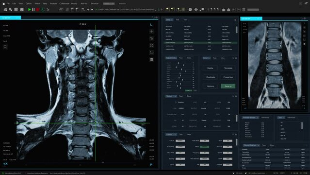 Magnetic Resonance Imaging Spinal Cord Scan Mock-up with Multiple Windows and Data. Professional Medical Research Software Template with MRI Results for Computer Displays and Laptop Screens.