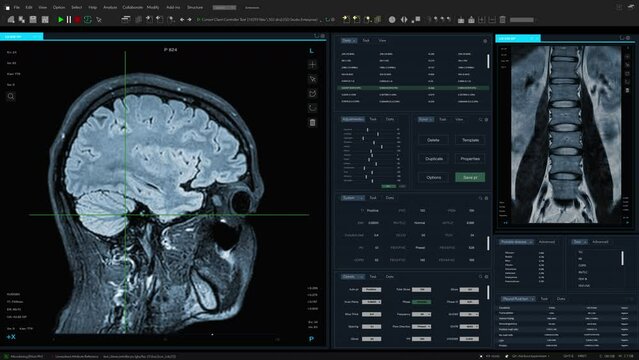 Magnetic Resonance Imaging Brain and Spinal Cord Scan Mock-up with Multiple Windows and Data. Medical Research Software Template with MRI Results for Computer Displays and Laptop Screens.