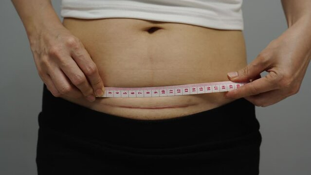 woman using tape measuring the c-section scar of cesarean on her belly