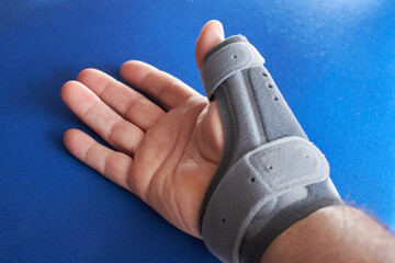 Hand with de quervain's tenosynovitis. Tendonitis. Wrist thumb abduction.