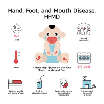 Hand, foot and mouth disease (HFMD) with symptoms prevention and treatment Infographics.