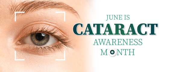 Eye of beautiful young woman, closeup. Banner for Cataract Awareness Month
