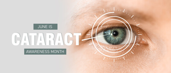 Eye of young man, closeup. Banner for Cataract Awareness Month - obrazy, fototapety, plakaty
