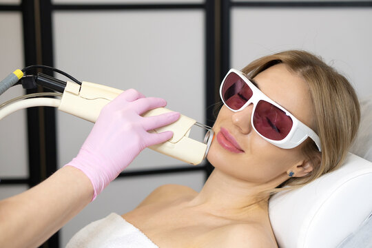 Laser epilation of the face on the device Alexandrite. innovations in laser hair removal technology. Close-up face of young woman getting laser facial hair removal procedure.