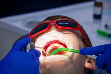 a boy with glasses with his mouth open at the dentist. dental treatment