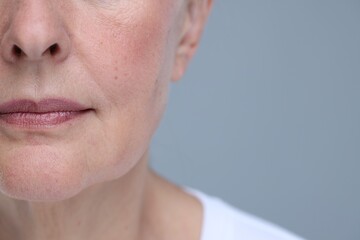 Senior woman with aging skin on grey background, closeup and space for text. Rejuvenation treatment