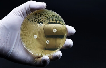Hand of scientist or doctor showing a microbiological culture Petri dish with bacteria where an...