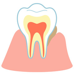歯茎が落ち隙間に溜まった歯垢