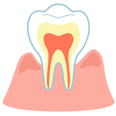 歯周ポケットの空いた歯