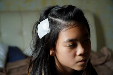 injured girl's head was bandaged white.Bandaged the wound. Concept of healthcare provision of first...