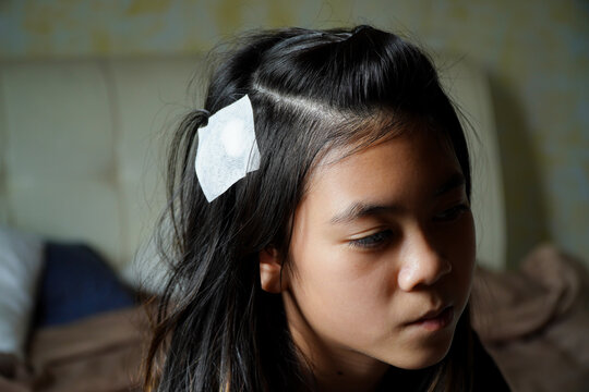 injured girl's head was bandaged white.Bandaged the wound. Concept of healthcare provision of first aid accident.