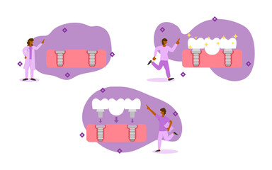dental prosthetics illustration set. dentist inserts two implant body into gum to prepare abutment with bridge. dental bridge implant to replace missing teeth. dental bridge implant treatment concept.