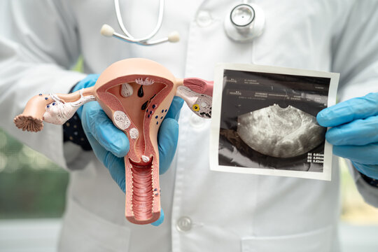 Uterus and ovary, doctor holding anatomy model and ultrasound picture for study diagnosis and treatment in hospital.