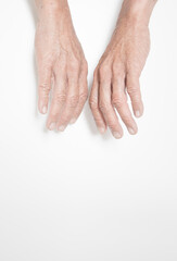 Fototapeta premium Fingers of elderly people with symptoms of muscle and joint problems, bone marrow