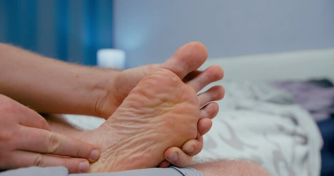 Close up shot of a warty white man foot. Man hand inspect the skin near the infected area