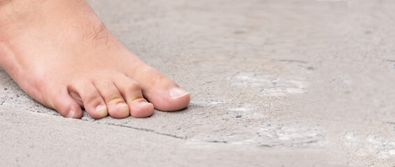 Man's Foot, Vital Footcare: Close-Up of a Man's Feet Walking on Cement - Promoting Healthy Feet and Nurturing Foot Hygiene.  Photography.