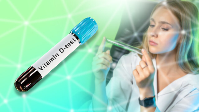 Vitamin d test. Doctor woman. Test tube with blood. Analysis for vitamin d content. Girl checks patient's blood. Woman doctor looks at sample of blood. Vitamin d research. Health care