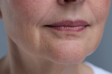 Senior woman with aging skin on grey background, closeup. Rejuvenation treatment