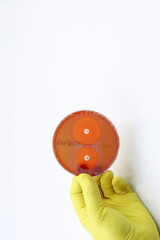 Hand of scientist or doctor with yellow glove showing a microbiological culture Petri dish with bacteria where an antibiotic resistance test has been carried out