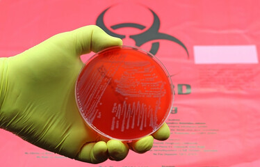A medium Agar-Blood Petri dish with a culture of the Superbug Acinetobacter baumannii