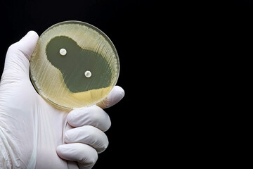 and of scientist or doctor showing a microbiological culture Petri dish with bacteria where an...