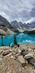 Obraz premium Vertical shot of the Louise lake in a mountainous landscape at daytime in Canada