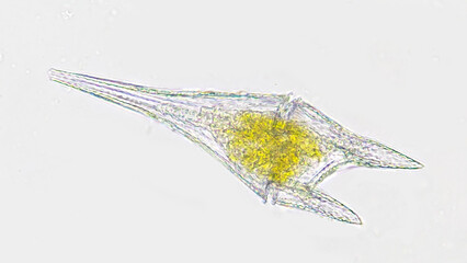 Marine dinoflagellate, Ceratium furca. Live cell. 400x magnification. Stacked photo