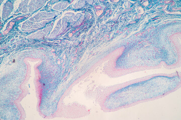 Showing Light micrograph of the Adrenal gland and Urinary bladder human under the microscope for...