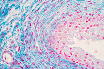 Showing Light micrograph of the Adrenal gland and Urinary bladder human under the microscope for...