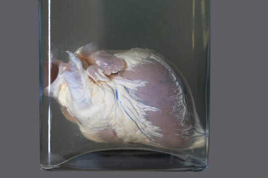 April 1, 2023 Belarus, Minsk.Exhibition of the anatomical exhibit of the human heart. Exhibits of the Museum of Anthropology and Ethnography.