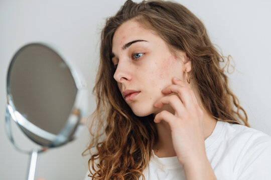 Beautiful  woman with problem skin looking into mirror. Dermatology. Allergic reaction from cosmetic, red spot or rash on face. Beauty care from skin problem.