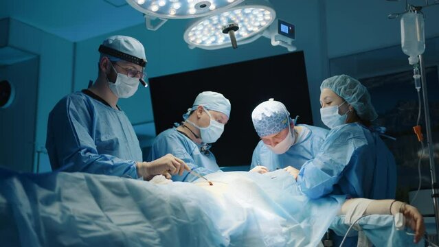 Process of plastic surgery procedure performed in modern operating room with led operation theatre light, monitor. Surgical team consists of four people. High quality 4k footage