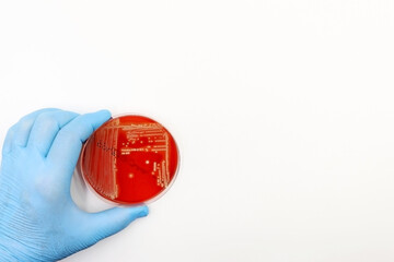 Doctor's or scientist's glove with a Petri dish with Agar-Blood medium with a culture of the bacteria Methicillin-resistant Staphylococcus aureus (MRSA) 