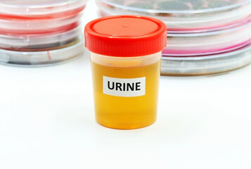 A urine sample in the microbiology laboratory. Space for text