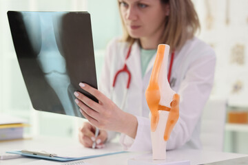 Doctor holds X-ray image of joint next to knee skeleton