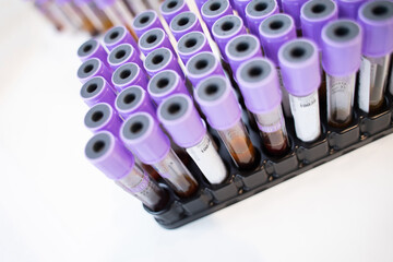 Laboratory vacuum blood sampling tubes on white background
