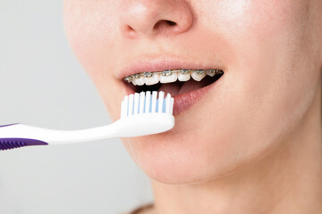 Photo of a young woman with braces on her teeth brushing her teeth with a toothbrush close-up. dental and oral care.