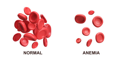 3d flow red blood cells iron platelets erythrocyte. Normal and Anemia. Realistic medical analysis illustration isolated transparent png background