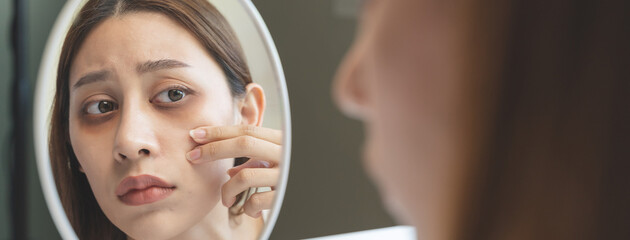 lack of sleep problem, Worried Asian young woman pointing finger at dark circles under her eyes