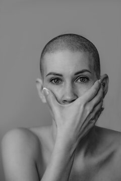Portrait of an emotional young beautiful woman with a shaved head close-up, she covers her mouth with her hand. The result of chemotherapy in the treatment of breast cancer. Black and white photo