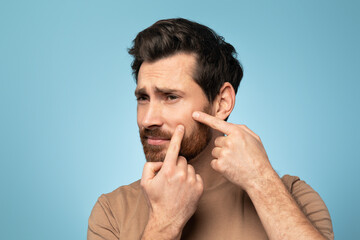Bearded middle aged man touching his face, removing blackheads, pressing pimple on face with fingers, blue background